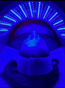 LED Acne Clearing Treatment